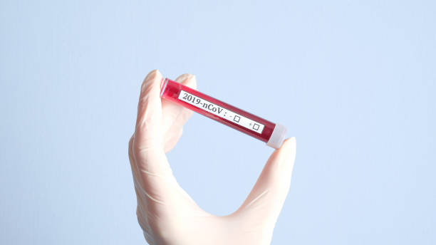 coronavirus surge - hep a vaccine recommendations cdc